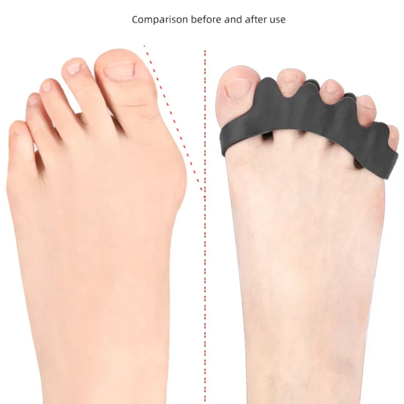 2 Silicone Toe Spacers